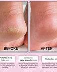 exfoliating foot peel mask - grace & stella