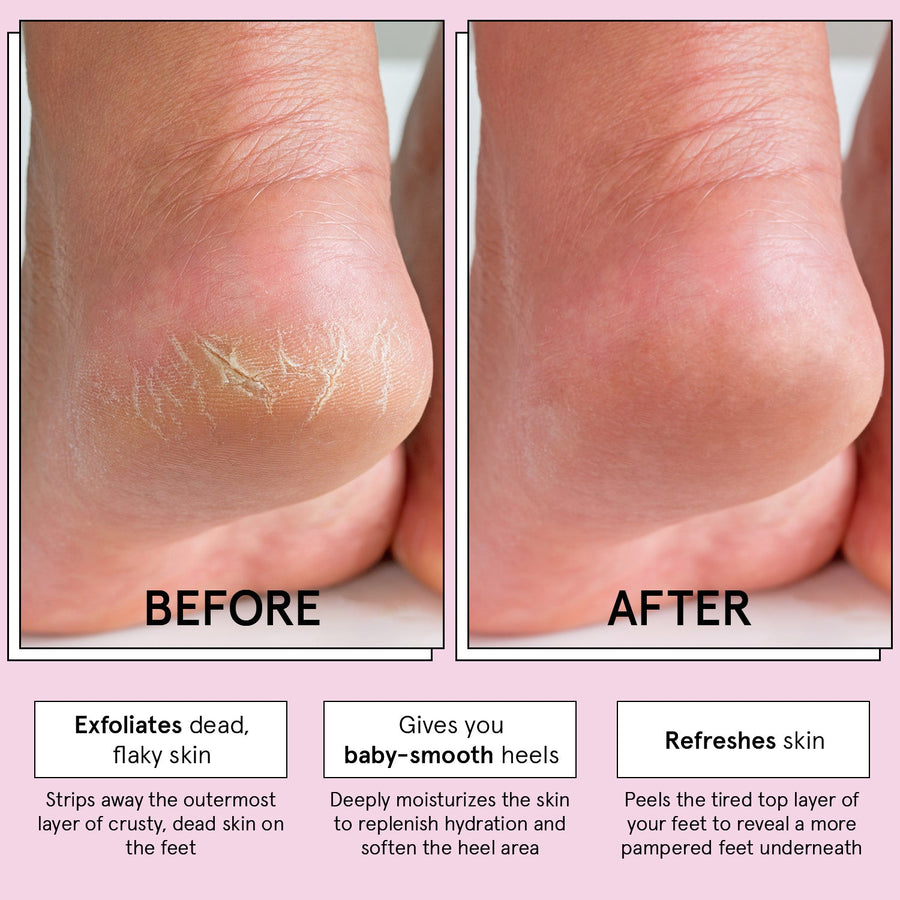 exfoliating foot peel mask - grace & stella